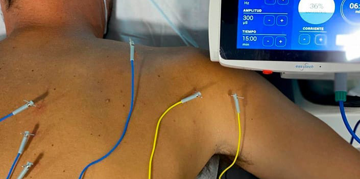 Neuromodulación Ecoguiada